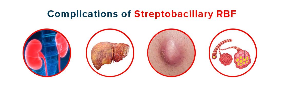 Complications of streptobacillary RBF